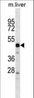 PRSS16 Antibody (aa52-81)
