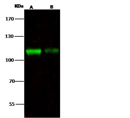 Polyclonal Rabbit anti-Human NCAPH / CAP-H Antibody (Preservative Free, IF, WB)