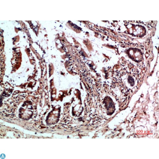 CYFIP2 / PIR121 Antibody