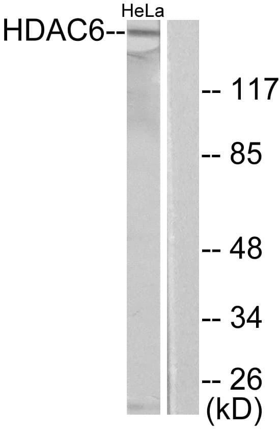 PathPlus™ Polyclonal Rabbit anti-Human HDAC6 Antibody (aa1166-1215, IHC, WB)