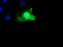 SCYL3 Antibody (clone OTI4F10)