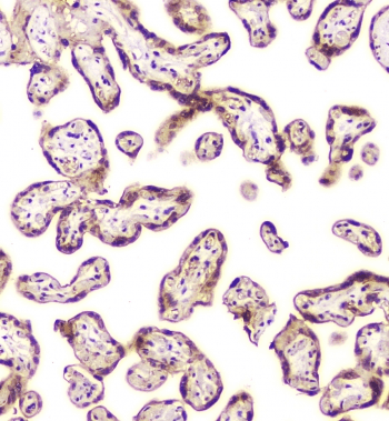 CHM / REP1 Antibody