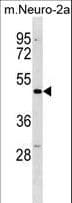 Polyclonal Rabbit anti-Mouse DCDC2 Antibody (aa373-400, WB)