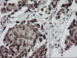 CHN1 Antibody (clone OTI2G6)