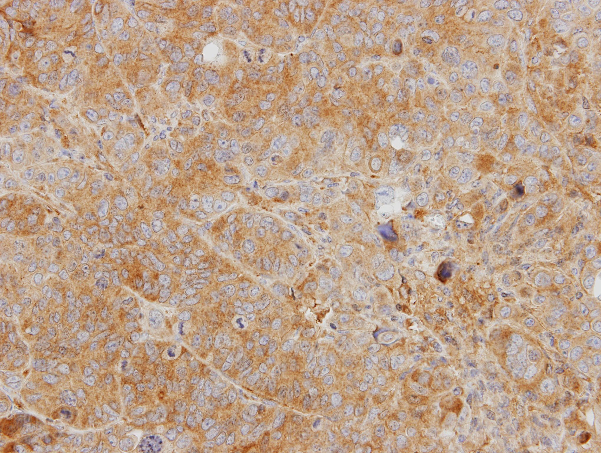YKL39 / CHI3L2 Antibody (aa27-374)