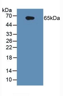 IL1R1 Antibody (aa21-109)