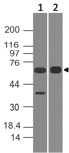 ALAS1 Antibody