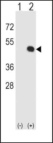 HLA-E Antibody (aa108-135)