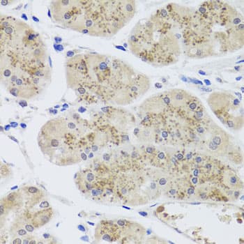 Polyclonal Rabbit anti-Human MTERF2 / MTERFD3 Antibody (IHC, WB)