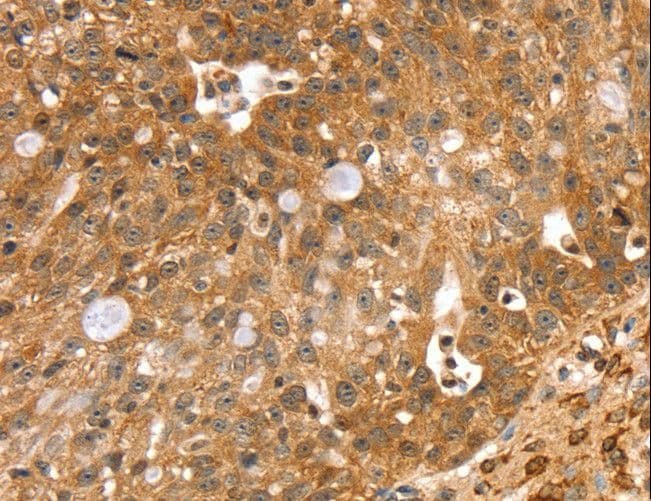 Polyclonal Rabbit anti-Human SORT1 / Sortilin Antibody (IHC)