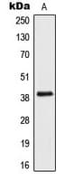 AIM2 Antibody (Internal)