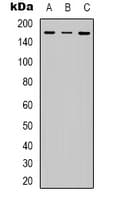 IRS1 Antibody (phospho-Ser312)