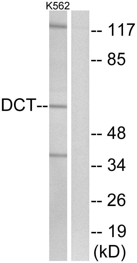 DCT / Dopachrome Tautomerase Antibody