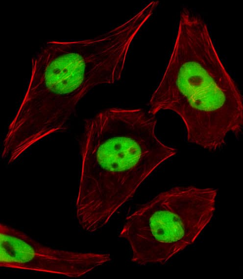 IHC-plus™ SUMO2 + SUMO3 Antibody (aa49-81)