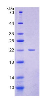 Human DPPA3 / STELLA Protein (Recombinant His-T7)