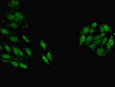 GSTT1 Antibody