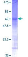 Human RNF138 Protein (Recombinant GST)