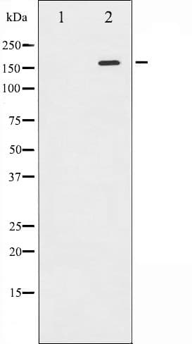 MAP3K5 / ASK1 Antibody (phospho-Ser966)