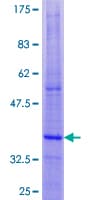 Human DAP12 Protein (Recombinant GST)