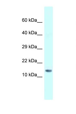 SNRPD1 / SMD1 Antibody (N-Terminus)