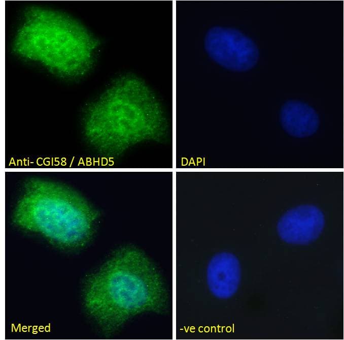 IHC-plus™ ABHD5 Antibody (aa181-192)