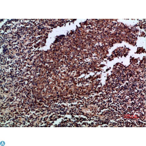 Polyclonal Rabbit anti-Human CSF2 / GM-CSF Antibody (IHC)