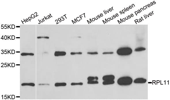 RPL11 / Ribosomal Protein L11 Antibody