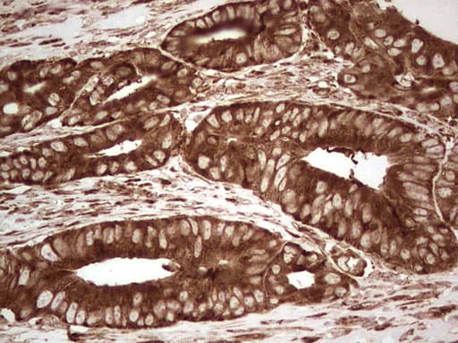 YBX1 / YB1 Antibody (clone OTI7B4)