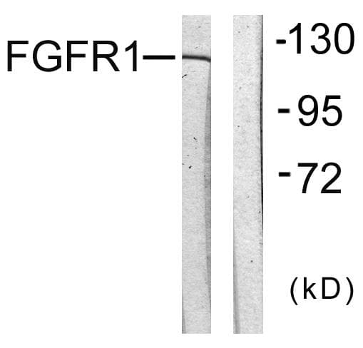 FGFR1 / FGF Receptor 1 Antibody (p654)