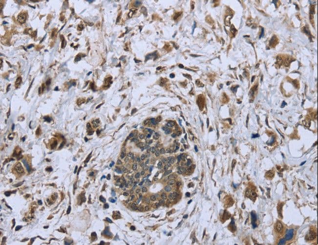 Polyclonal Rabbit anti-Human DCTN4 / Dynactin 4 Antibody (IHC)