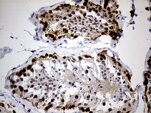 IMP-3 / IGF2BP3 Antibody (clone OTI7B10)