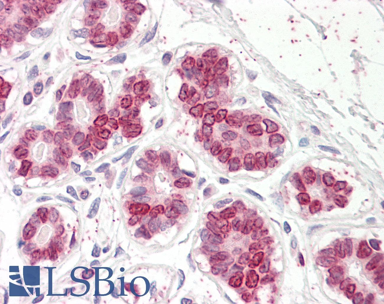 IHC-plus™ Polyclonal Goat anti-Human UBASH3A / CLIP4 Antibody (aa470-482, IHC, WB)