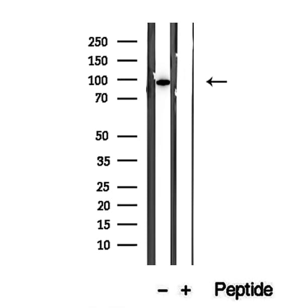 CX3CL1 / Fractalkine Antibody