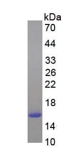 Human FABP4 / AP2 Protein (Recombinant His, N-Terminal)