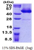 Human AAGAB Protein (Recombinant His)