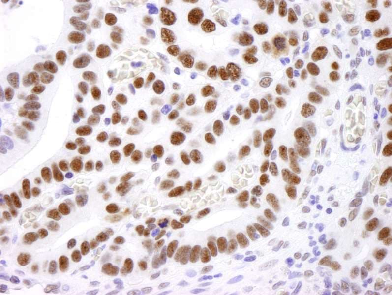 Polyclonal Rabbit anti-Human NCL / Nucleolin Antibody (aa250-300, IHC, WB)