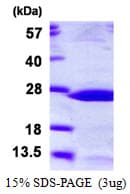 Human HSPB2 / HSP27 Protein (Recombinant His)
