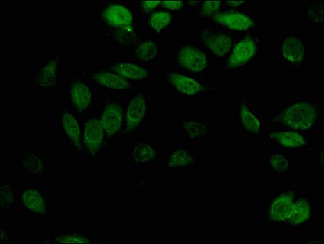 AKR1B1 / Aldose Reductase Antibody