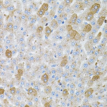 RPS6KA3 / RSK2 Antibody