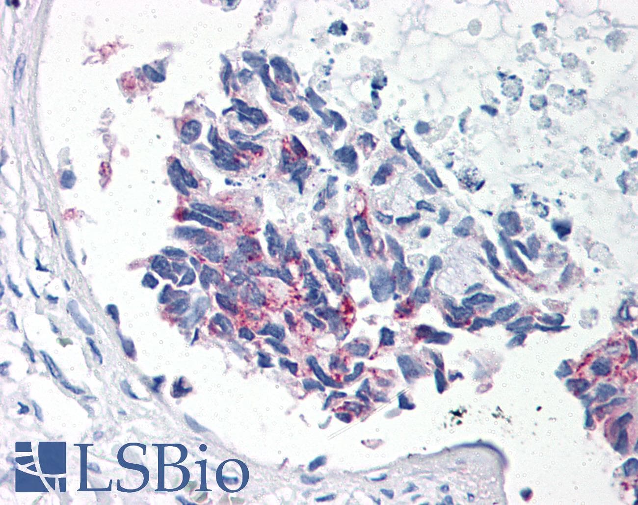 IHC-plus™ BIRC5 / Survivin Antibody (clone 32.1)