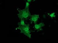 DNAJB1 / Hsp40 Antibody (clone OTI1A12)