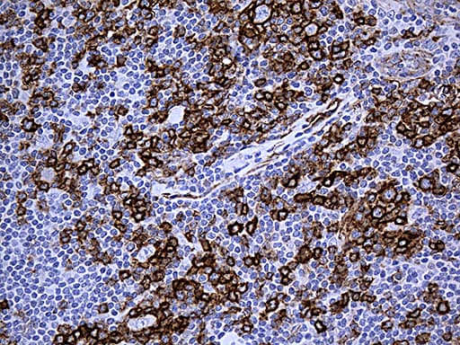 Monoclonal Mouse anti-Human CAV1 / Caveolin 1 Antibody (clone OTI2C4, Carrier-free, aa2-104, IHC, WB)