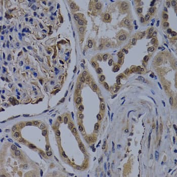 Polyclonal Rabbit anti-Human WDR5 Antibody (IHC, IF, WB)