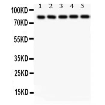 Polyclonal Rabbit anti-Human SOX5 Antibody (aa495-528, WB)