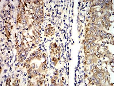Monoclonal Mouse anti-Human AGR2 Antibody (clone 5G1F8, IHC, WB)