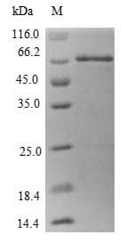 Human MT3 / Metallothionein 3 Protein (Recombinant GST, N-terminus)