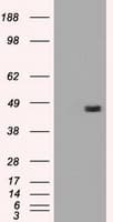 IHC-plus™ Monoclonal Mouse anti-Human SERPINA1 / Alpha 1 Antitrypsin Antibody (clone 1C2, IHC, IF, WB)