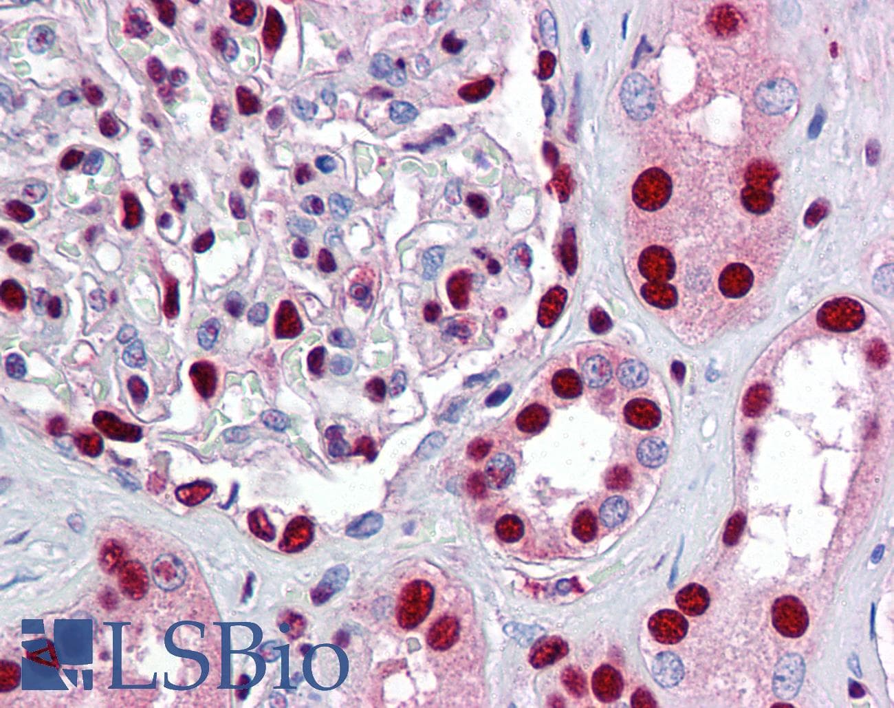 IHC-plus™ TP53BP1 / 53BP1 Antibody (aa350-400)