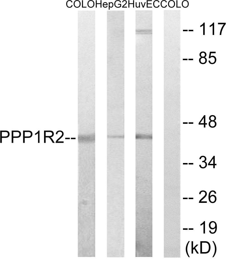 IPP2 / PPP1R2 Antibody (Ab-44)