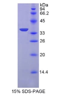 Human TNNT2 / CTNT Protein (Recombinant His)